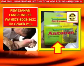 0878-8005-8622 Obat Gejala Kaki Kram Di Kota Palu