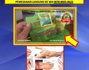 Wa: 0878-8005-8622 Obat Asam Urat Bengkak Lutut Di Kota Palu