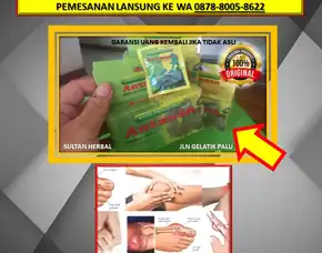 0878-8005-8622 Obat Asam Urat Itu Apa Namanya Di Kota Palu