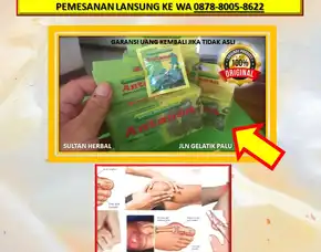 0878-8005-8622 Obat Asam Urat Normal Wanita Di Kota Palu