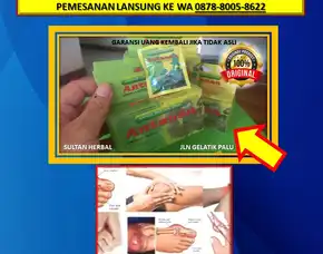 0878-8005-8622 Obat Alami Mengatasi Kolesterol Di Kota Palu