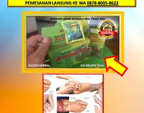 0878-8005-8622 Obat Asam Urat Kaki Di Kota Palu