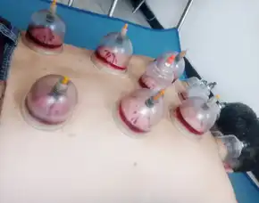 Pijat Dan Bekam Tajinan Malang