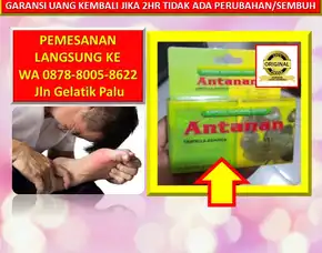 0878-8005-8622 Obat Asam Urat Kaki Bengkak Dan Nyeri Di Kota Palu