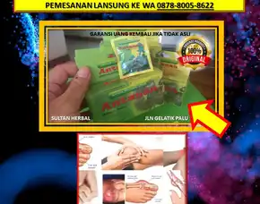 0878-8005-8622 Obat Asam Urat Untuk Kaki Bengkak Di Kota Palu