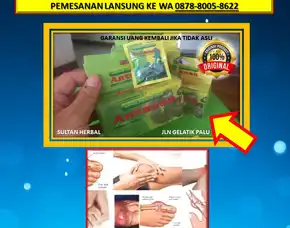 Wa: 0878-8005-8622 Obat Asam Urat Rendam Kaki Di Kota Palu