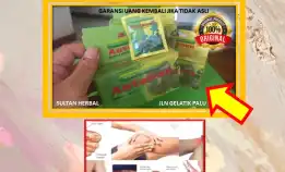 0878-8005-8622 Obat Asam Urat Apotik Di Kota Palu