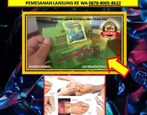 Wa: 0878-8005-8622 Obat Asam Urat Obat Warung Di Kota Palu