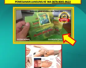 Wa: 0878-8005-8622 Obat Kolesterol Cepat Turun Di Kota Palu