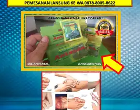 0878-8005-8622 Obat Asam Urat Herbal Di Apotik Di Kota Palu
