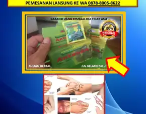 0878-8005-8622 Obat Kolesterol Secara Alami Di Kota Palu
